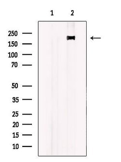 ALPK2 Polyclonal Antibody, Invitrogen 100 &mu;L; Unconjugated:Antibodies,