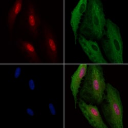 Invitrogen CDKL4 Polyclonal Antibody 100 &mu;L; Unconjugated:Antibodies,