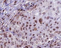 Invitrogen CDKL4 Polyclonal Antibody 100 &mu;L; Unconjugated:Antibodies,