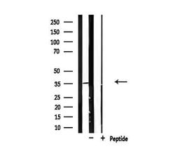Invitrogen CDKL4 Polyclonal Antibody 100 &mu;L; Unconjugated:Antibodies,