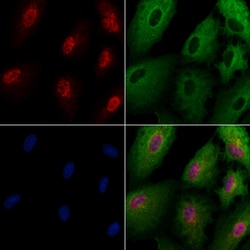 Invitrogen AK6 Polyclonal Antibody 100 &mu;L | Buy Online | Invitrogen&trade; | Fisher Scientific