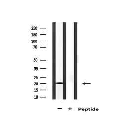 Invitrogen AK6 Polyclonal Antibody 100 &mu;L | Buy Online | Invitrogen&trade; | Fisher Scientific