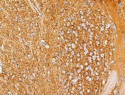 Invitrogen GAD65/GAD67 Polyclonal Antibody 100 &mu;L; Unconjugated:Antibodies,