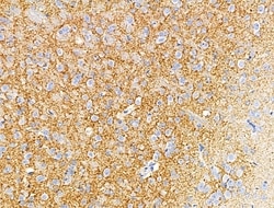 Invitrogen GAD65/GAD67 Polyclonal Antibody 100 &mu;L; Unconjugated:Antibodies,
