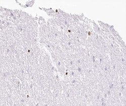 Invitrogen MOK Polyclonal Antibody 100 &mu;L; Unconjugated:Antibodies,