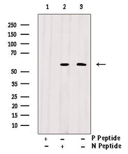 Phospho-AKT1/AKT2/AKT3 (Tyr315, Tyr316, Tyr312) Polyclonal Antibody, Invitrogen