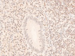 Invitrogen Phospho-JAK1 (Tyr1034) Polyclonal Antibody 100 &mu;L; Unconjugated:Antibodies,