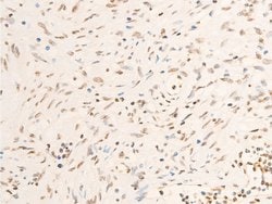 Invitrogen Phospho-JAK1 (Tyr1034) Polyclonal Antibody 100 &mu;L; Unconjugated:Antibodies,