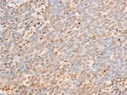Invitrogen Phospho-JAK1 (Tyr1034) Polyclonal Antibody 100 &mu;L; Unconjugated:Antibodies,