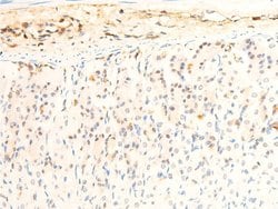 Invitrogen Phospho-JAK1 (Tyr1034) Polyclonal Antibody 100 &mu;L; Unconjugated:Antibodies,