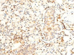 Invitrogen Phospho-JAK1 (Tyr1034) Polyclonal Antibody 100 &mu;L; Unconjugated:Antibodies,