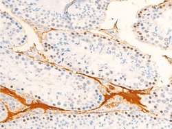 Invitrogen Phospho-JAK1 (Tyr1034) Polyclonal Antibody 100 &mu;L; Unconjugated:Antibodies,