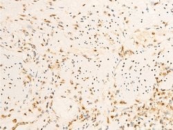 Invitrogen Phospho-JAK1 (Tyr1034) Polyclonal Antibody 100 &mu;L; Unconjugated:Antibodies,