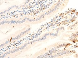 Invitrogen Phospho-JAK1 (Tyr1034) Polyclonal Antibody 100 &mu;L; Unconjugated:Antibodies,