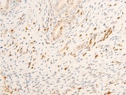 Invitrogen Phospho-JAK1 (Tyr1034) Polyclonal Antibody 100 &mu;L; Unconjugated:Antibodies,