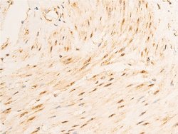 Invitrogen Phospho-GSK3B (Ser9) Polyclonal Antibody 100 &mu;L; Unconjugated:Antibodies,