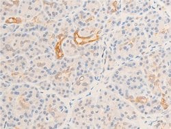 Invitrogen Phospho-GSK3B (Ser9) Polyclonal Antibody 100 &mu;L; Unconjugated:Antibodies,