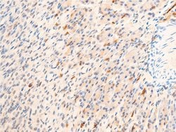 Invitrogen Phospho-GSK3B (Ser9) Polyclonal Antibody 100 &mu;L; Unconjugated:Antibodies,