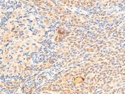 Invitrogen Phospho-GSK3B (Ser9) Polyclonal Antibody 100 &mu;L; Unconjugated:Antibodies,