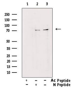 Invitrogen Acetyl-FOXO1 (Lys294) Polyclonal Antibody 100 &mu;L; Unconjugated:Antibodies,