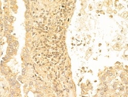 Invitrogen Acetyl-FOXO1 (Lys294) Polyclonal Antibody 100 &mu;L; Unconjugated:Antibodies,