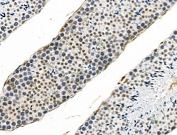 Invitrogen Phospho-4EBP1 (Ser65, Thr70) Polyclonal Antibody 100 &mu;L;