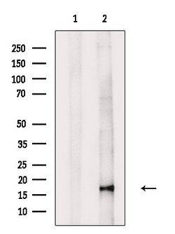 Invitrogen Phospho-4EBP1 (Ser65, Thr70) Polyclonal Antibody 100 &mu;L;