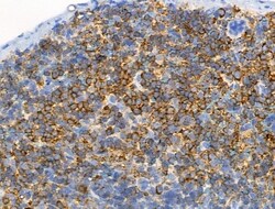 Invitrogen Phospho-ALK (Tyr1604) Polyclonal Antibody 100 &mu;L; Unconjugated:Antibodies,
