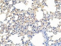 Invitrogen Phospho-ALK (Tyr1604) Polyclonal Antibody 100 &mu;L; Unconjugated:Antibodies,