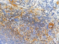 Invitrogen Phospho-ALK (Tyr1604) Polyclonal Antibody 100 &mu;L; Unconjugated:Antibodies,