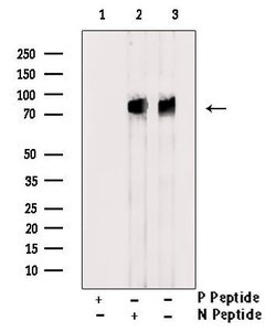 Invitrogen Phospho-ALK (Tyr1604) Polyclonal Antibody 100 &mu;L; Unconjugated:Antibodies,
