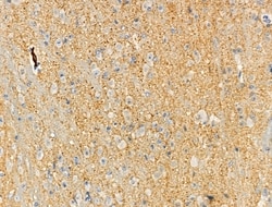 Phospho-Cdc25B (Ser151) Polyclonal Antibody 100 &mu;L | Buy Online | Invitrogen | Fisher Scientific