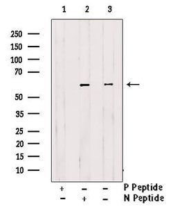 Phospho-Cdc25B (Ser151) Polyclonal Antibody 100 &mu;L | Buy Online | Invitrogen | Fisher Scientific