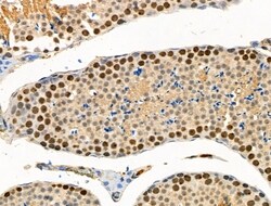Invitrogen Phospho-BAP1 (Ser592) Polyclonal Antibody 100 &mu;L; Unconjugated:Antibodies,