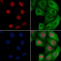 Invitrogen Phospho-BCL9L (Ser915) Polyclonal Antibody 100 &mu;L; Unconjugated:Antibodies,