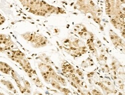 Invitrogen Phospho-BCL9L (Ser915) Polyclonal Antibody 100 &mu;L; Unconjugated:Antibodies,