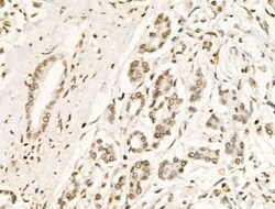 Invitrogen Phospho-BCL9L (Ser915) Polyclonal Antibody 100 &mu;L; Unconjugated:Antibodies,