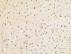 Invitrogen Phospho-BCL9L (Ser915) Polyclonal Antibody 100 &mu;L; Unconjugated:Antibodies,