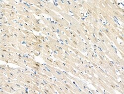 Invitrogen Phospho-BCL9L (Ser915) Polyclonal Antibody 100 &mu;L; Unconjugated:Antibodies,