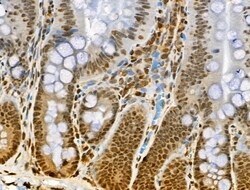 Invitrogen Phospho-BCL9L (Ser915) Polyclonal Antibody 100 &mu;L; Unconjugated:Antibodies,
