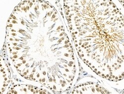 Invitrogen Phospho-BCL9L (Ser915) Polyclonal Antibody 100 &mu;L; Unconjugated:Antibodies,