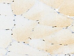 Invitrogen Phospho-BCL9L (Ser915) Polyclonal Antibody 100 &mu;L; Unconjugated:Antibodies,