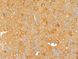 Invitrogen Phospho-Beclin 1 (Ser15) Polyclonal Antibody 100 &mu;L; Unconjugated:Antibodies,