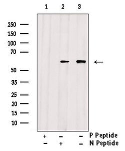Invitrogen Phospho-Beclin 1 (Ser15) Polyclonal Antibody 100 &mu;L; Unconjugated:Antibodies,