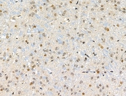 Invitrogen Phospho-BMAL1 (Ser42) Polyclonal Antibody 100 &mu;L | Buy Online | Invitrogen&trade; | Fisher Scientific