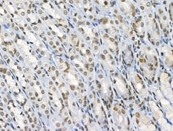 Invitrogen Phospho-BMAL1 (Ser42) Polyclonal Antibody 100 &mu;L | Buy Online | Invitrogen&trade; | Fisher Scientific