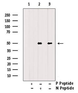 Invitrogen&trade;&nbsp;Phospho-CaMKII alpha/beta/delta (Tyr231) Polyclonal Antibody