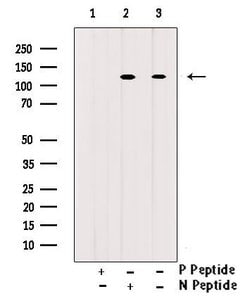Invitrogen Phospho-c-Cbl (Tyr700) Polyclonal Antibody 100 &mu;L | Buy Online | Invitrogen&trade; | Fisher Scientific