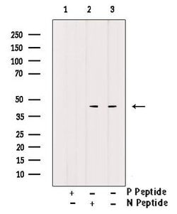 Invitrogen Phospho-CD79a (Tyr182) Polyclonal Antibody 100 &mu;L; Unconjugated:Antibodies,
