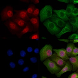 Invitrogen Phospho-CTDSPL2 (Ser104) Polyclonal Antibody 100 &mu;L; Unconjugated:Antibodies,